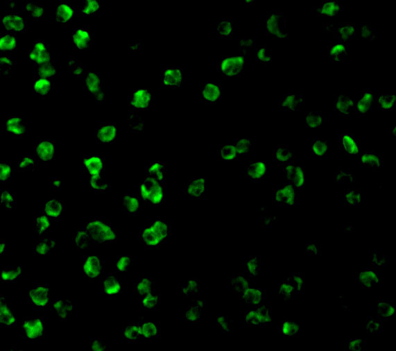 Immunofluorescence of SARM in Daudi cells with SARM antibody at 2 μg/mL