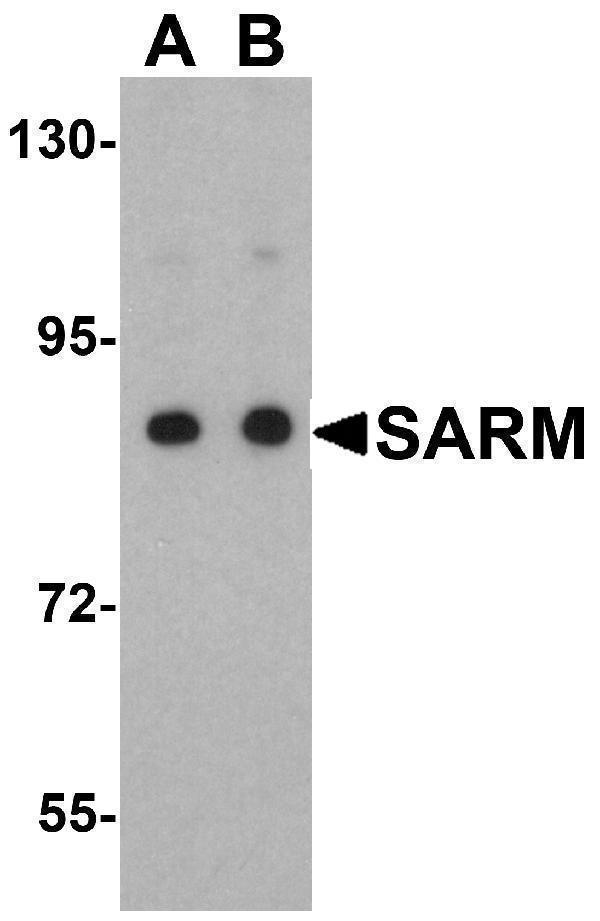 Western blot analysis of SARM in Daudi cell lysate with SARM antibody at (A) 0