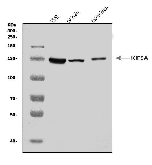  Western blot analysis of KIF5A using anti-KIF5A antibody (A03635-1)
