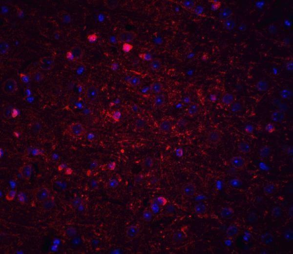 a03635 kif5a primary antibodies if testing 5