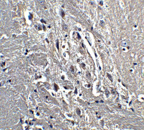 a03635 kif5a primary antibodies ihc testing 4