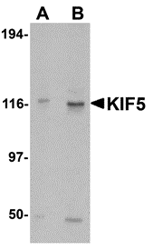 a03635 kif5a primary antibodies wb testing 1