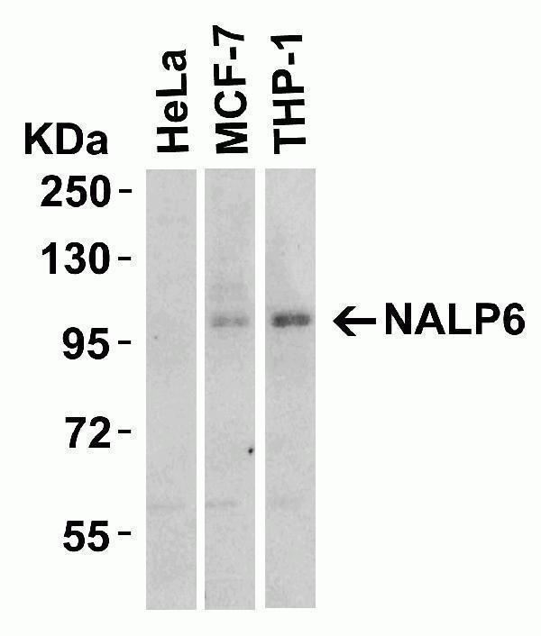 a03636 nlrp6 primary antibodies wb testing 1