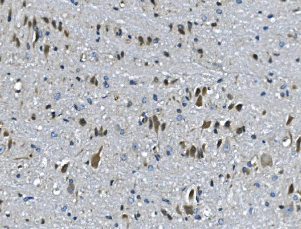 a03637 1 pawr primary antibodies ihc testing 4