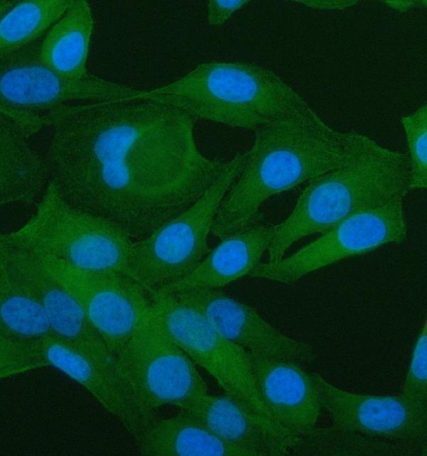  IF analysis of PAWR using anti-PAWR antibody (A03637-2)