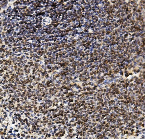 a03639 2 u2af2 primary antibodies ihc testing 4