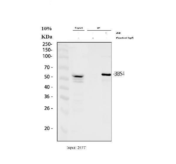 Immunoprecipitating BBS4 in 293T whole cell lysate