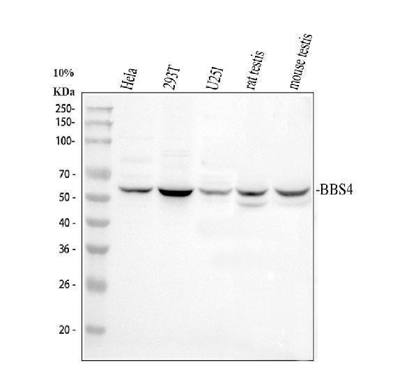 Western blot analysis of BBS4 using anti-BBS4 antibody (A03640-2)