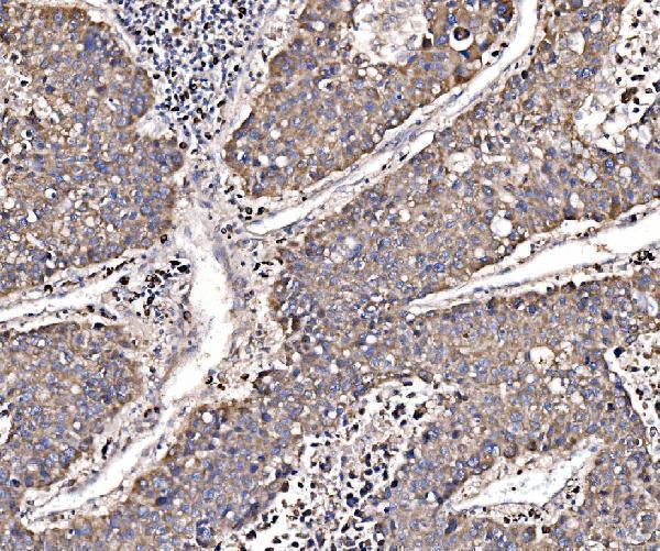  IHC analysis of GGA3 using anti-GGA3 antibody (A03641-2)