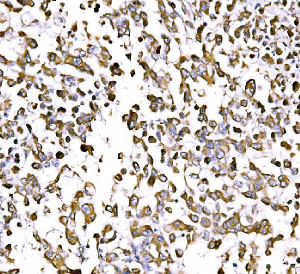  IHC analysis of GGA3 using anti-GGA3 antibody (A03641-2)
