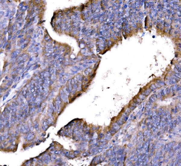 a03641 2 gga3 primary antibodies ihc testing 4