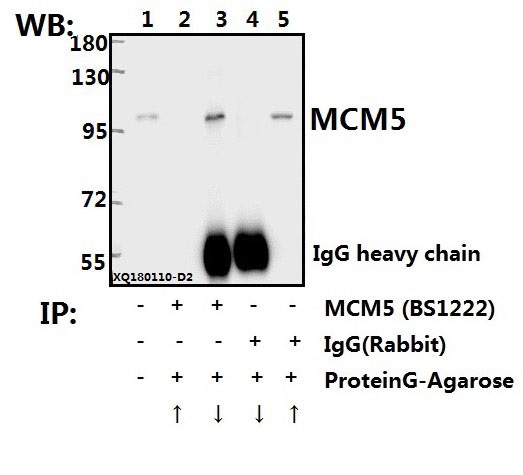 Immunoprecipitation of L02 cell lysate using MCM5 (F51) pAb (Sepharose Bead Conjugate) #BD0048(lane 2 and lane 3) and Nonspecific IgG  Control (Sepharose Bead Conjugate)#BD0047 (lane 4 and lane 5) 