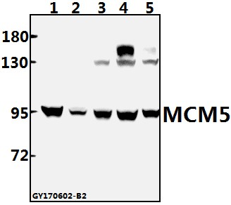 Western blot (WB) analysis of MCM5 (F51) polyclonal antibody at 1:500 dilution
Lane1:CT26 whole cell lysate(40ug)
Lane2:H9C2 whole cell lysate(40ug)
Lane3:A549 whole cell lysate(40ug)
Lane4:HEK293T whole cell lysate(40ug)
Lane5:MCF-7 whole cell lysate(40ug)