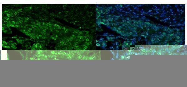 a03642 mcm5 primary antibodies if testing 5