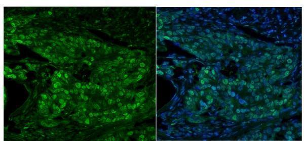 a03642 mcm5 primary antibodies if testing 5_1