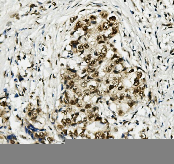  IHC analysis of MCM5 using anti-MCM5 antibody (A03642)