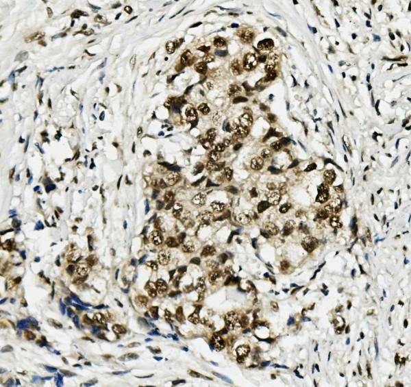 a03642 mcm5 primary antibodies ihc testing 2_1