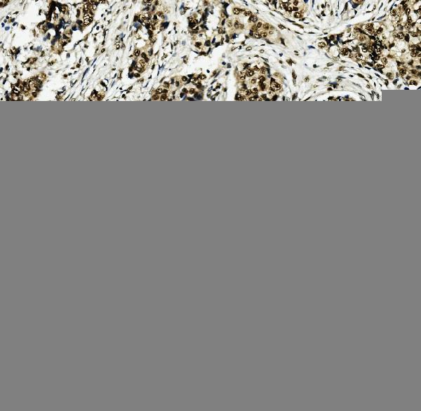  IHC analysis of MCM5 using anti-MCM5 antibody (A03642)