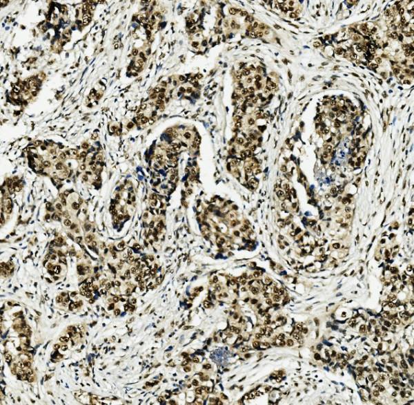 a03642 mcm5 primary antibodies ihc testing 3_1