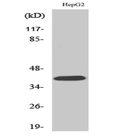 Western blot analysis of various cells using PAR-4 Polyclonal Antibody