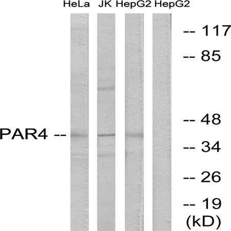 Western blot analysis of lysates from HepG2 and Jurkat/HeLa cells, using PAR4 Antibody