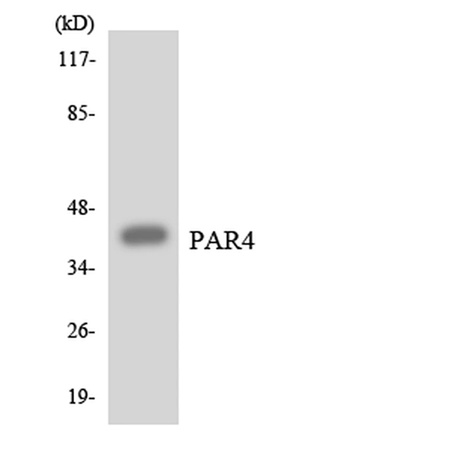 Western blot analysis of the lysates from HT-29 cells using PAR4 antibody