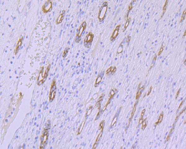 Immunohistochemical analysis of paraffin-embedded human liver tissue using anti-CYP26A1 antibody
