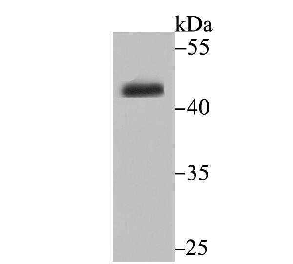 Western blot analysis of CYP26A1 on HepG2 cell lysate using anti-CYP26A1 antibody at 1/500 dilution