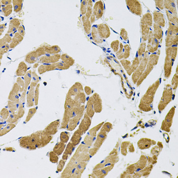 Immunofluorescence analysis of U2OS cells using MYO10 antibody  at dilution of 1:350