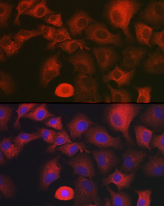 Immunofluorescence analysis of A-549 cells using MYO10 antibody  at dilution of 1:350