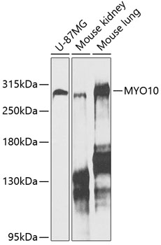 Western blot analysis of extracts of various cell lines, using MYO10 antibody  at 1:1000 dilution