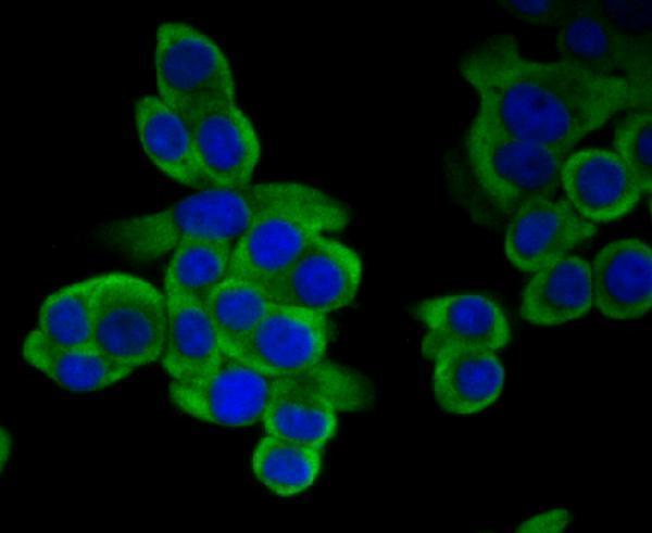 ICC staining Methionine Aminopeptidase 2 in LOVO cells (green)