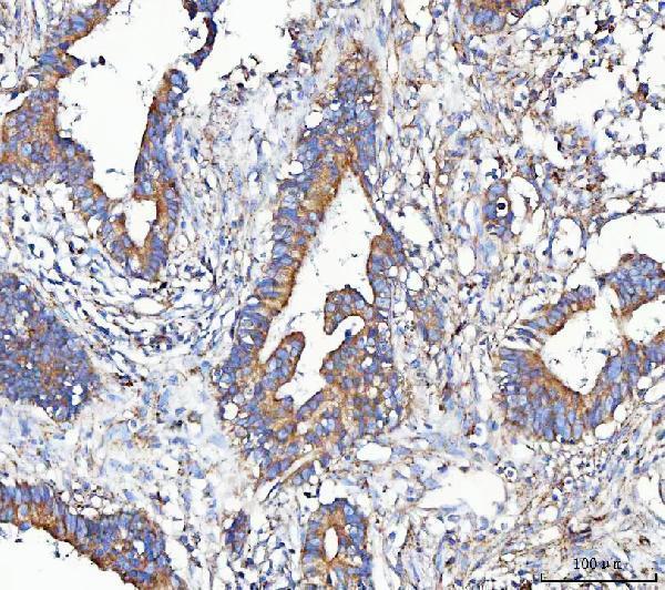  IHC analysis of METAP2 using anti-METAP2 antibody (A03648-2)