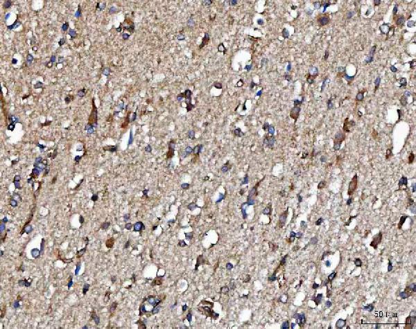 a03648 2 metap2 primary antibodies ihc testing 4