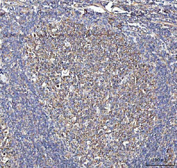 a03648 2 metap2 primary antibodies ihc testing 5