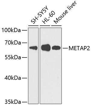a03648 metap2 primary antiboties wb testing 1
