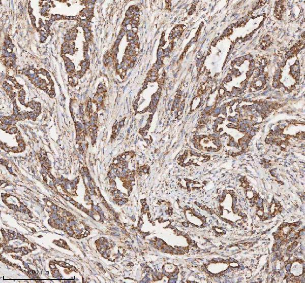a03650 1 hadh primary antibodies ihc testing 10