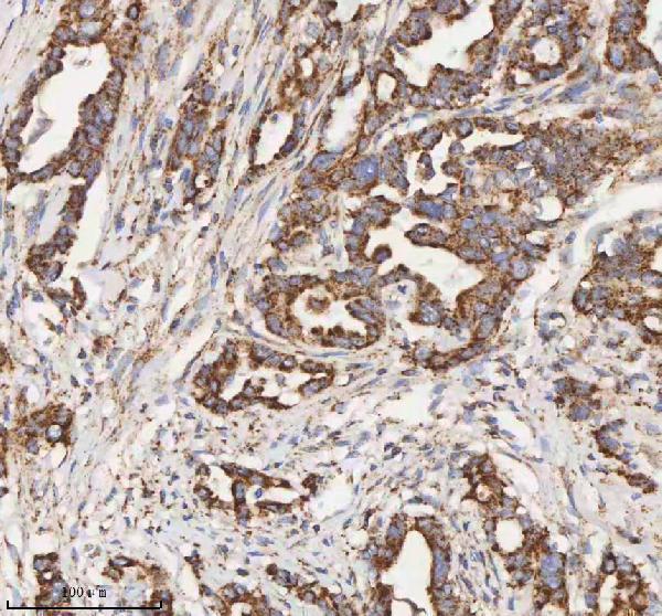 a03650 1 hadh primary antibodies ihc testing 11