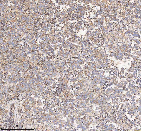 a03650 1 hadh primary antibodies ihc testing 12
