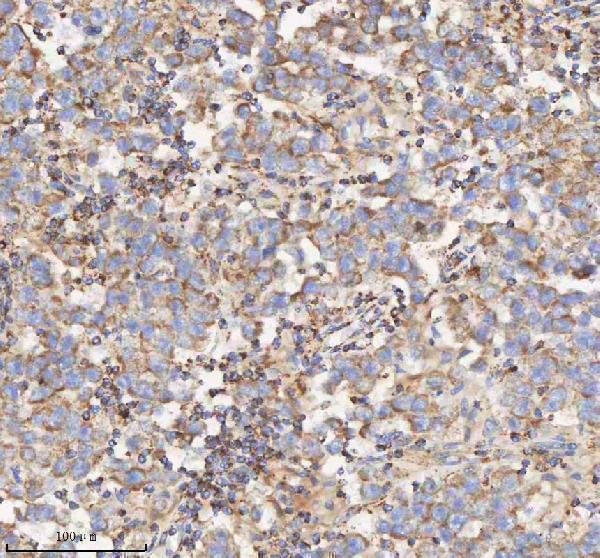 a03650 1 hadh primary antibodies ihc testing 13