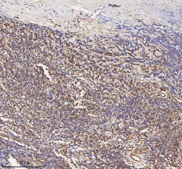 a03650 1 hadh primary antibodies ihc testing 14