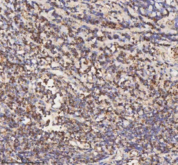 a03650 1 hadh primary antibodies ihc testing 15