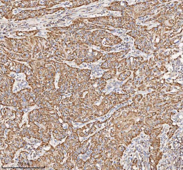 a03650 1 hadh primary antibodies ihc testing 16
