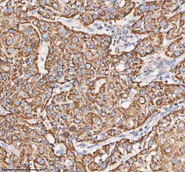 a03650 1 hadh primary antibodies ihc testing 17