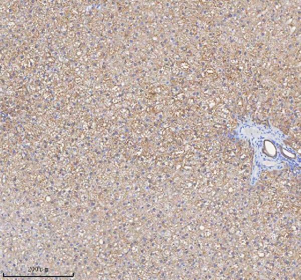 a03650 1 hadh primary antibodies ihc testing 18