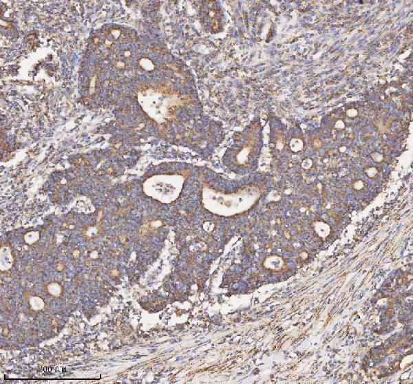  IHC analysis of HADH using anti-HADH antibody (A03650-1)