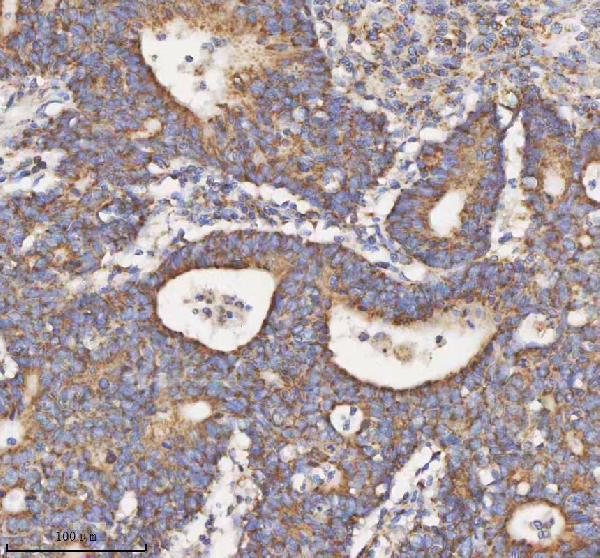  IHC analysis of HADH using anti-HADH antibody (A03650-1)