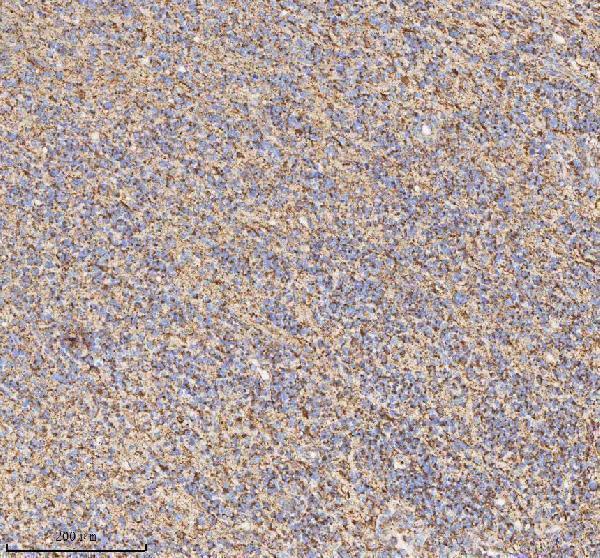 a03650 1 hadh primary antibodies ihc testing 4