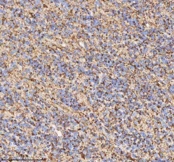 a03650 1 hadh primary antibodies ihc testing 5