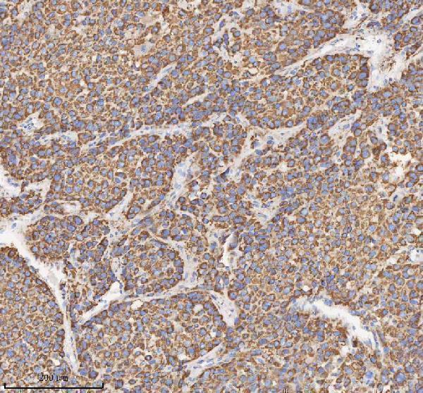 a03650 1 hadh primary antibodies ihc testing 6
